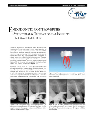 Endodontic Controversies: Structural &amp; Technological Insights