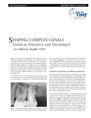 “Shaping Complex Canals”