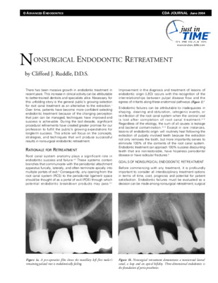 “Nonsurgical Endodontic Retreatment”